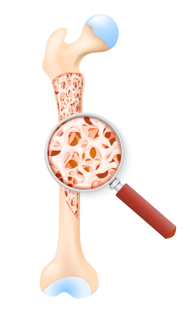 Cross section of a bone showing living tissue.